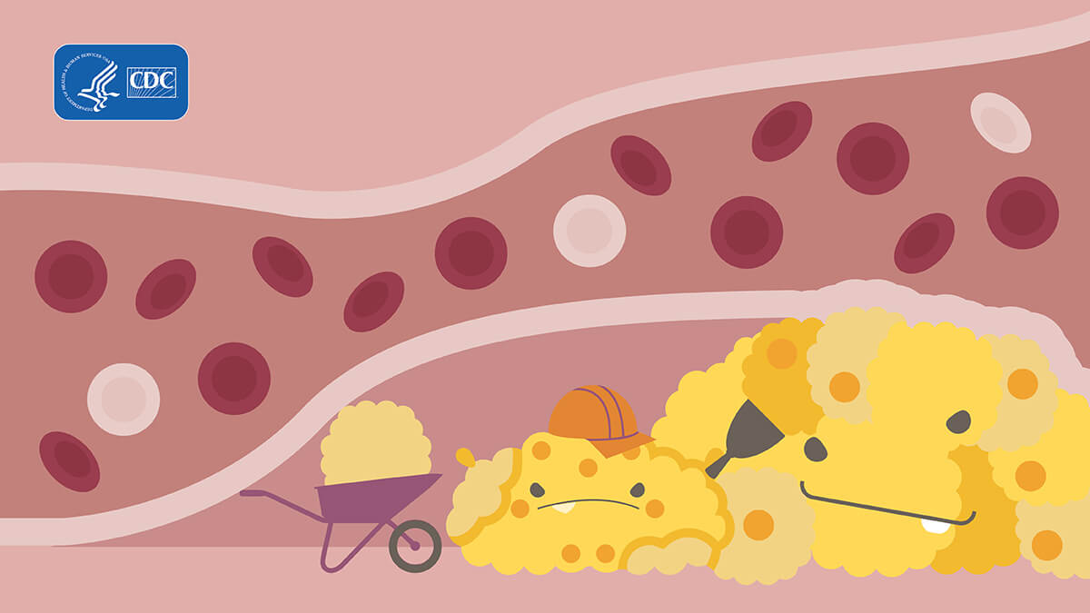 Illustration of yellow blob cholesterol monsters in arteries