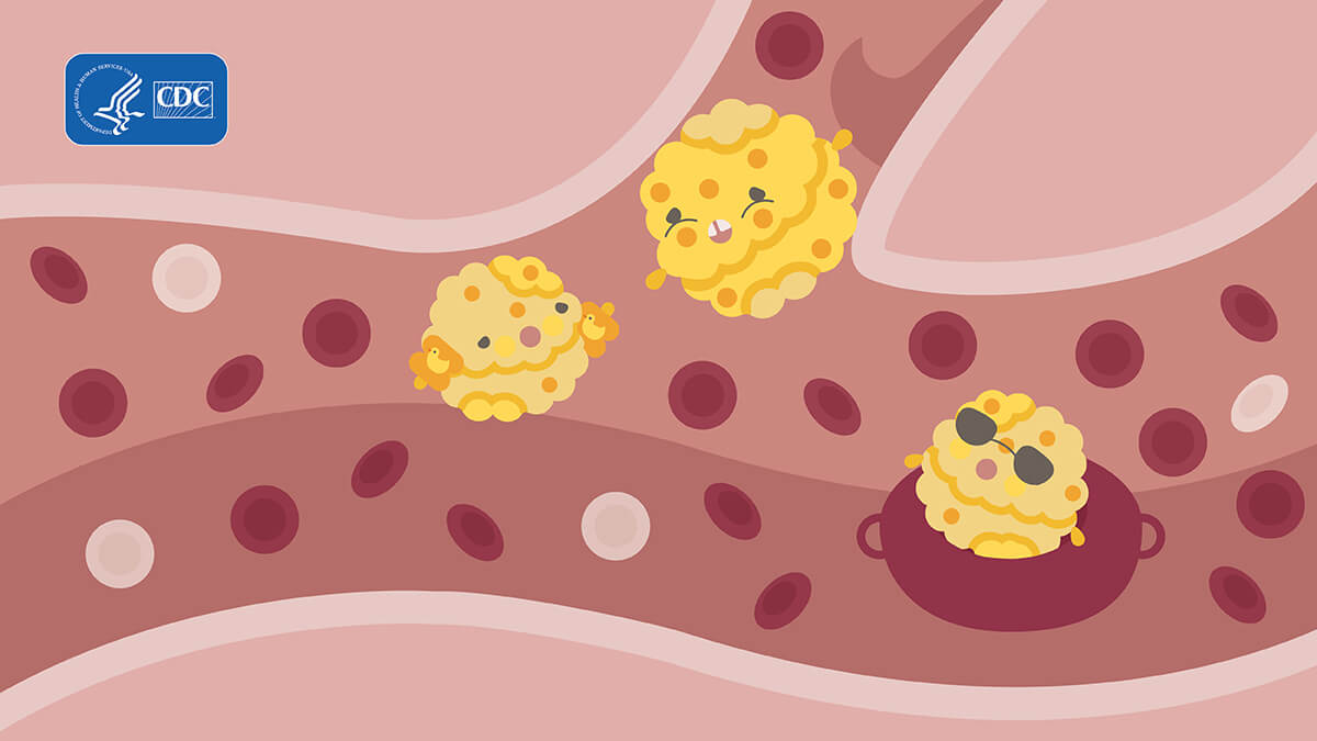 Illustration of yellow blob cholesterol monsters in arteries